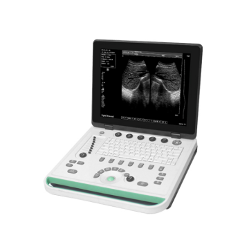 Type de Labtop Ultrasound portable